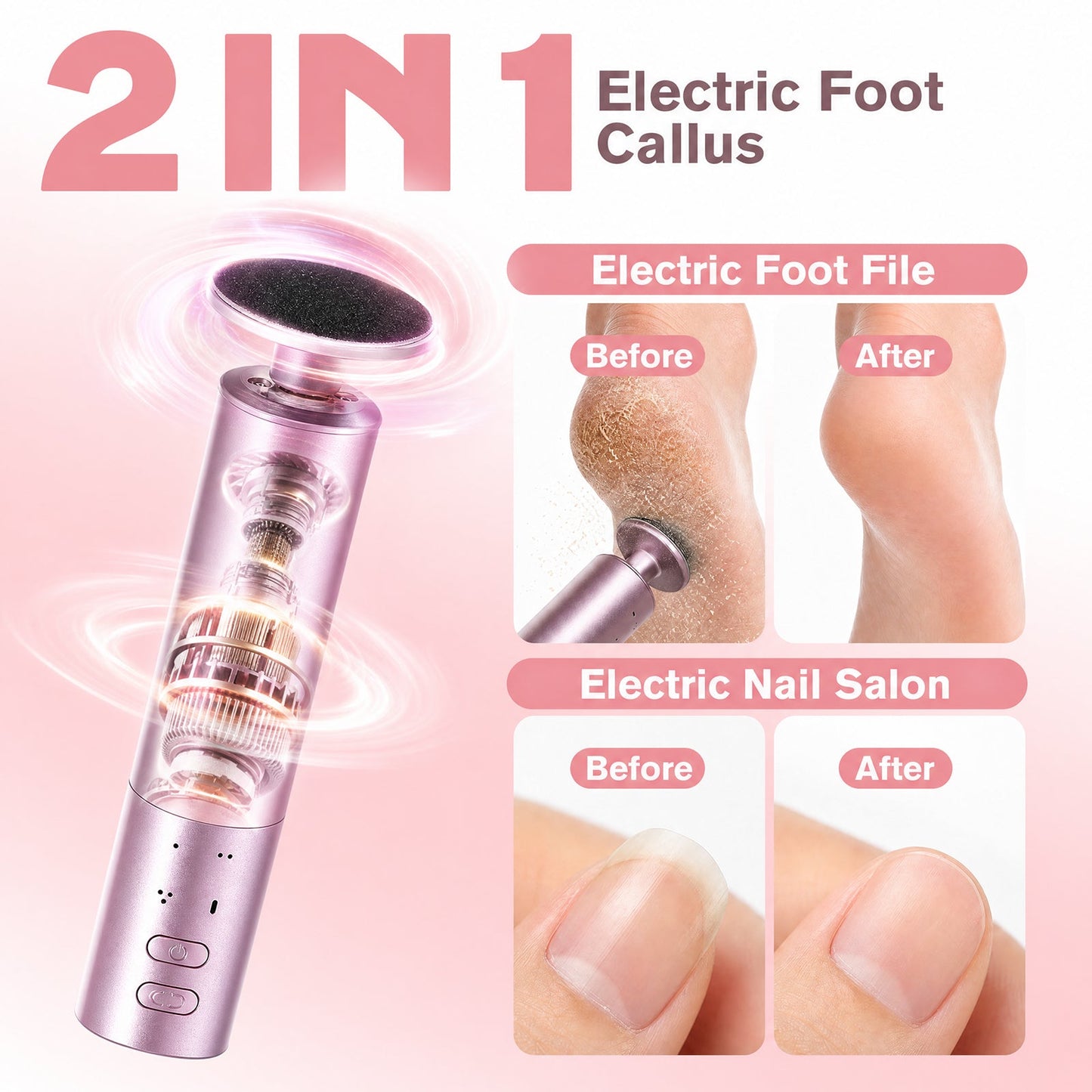 Advwin 2-IN-1 Foot Callus Remover 6-Speed Control
